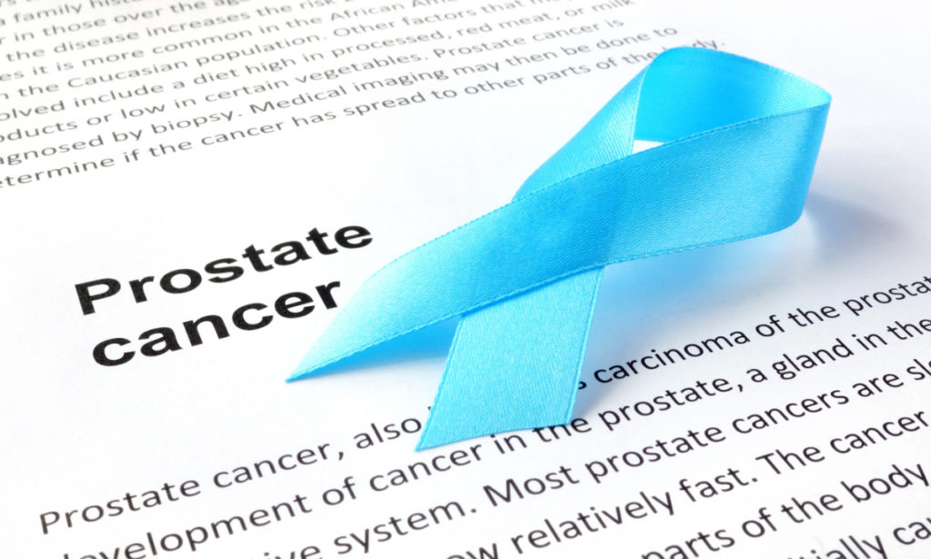 Understanding Prostate Cancer Treatments And How To Avoid The Onset