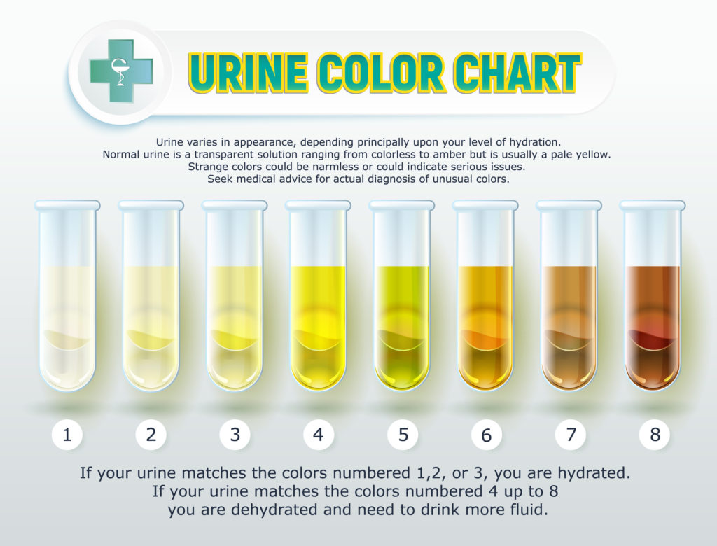 darker urine due to vitamins dark urine